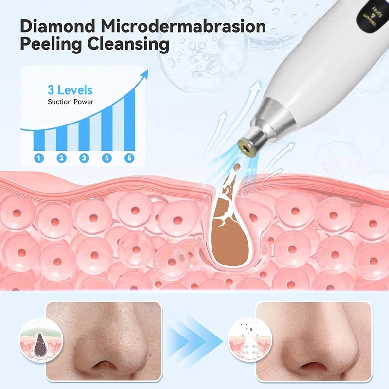 Upgraded Diamond Microdermabrasion Machine Blackhead Removal Professional Facial Deep Cleasing Device Home Use Facial Skin Care