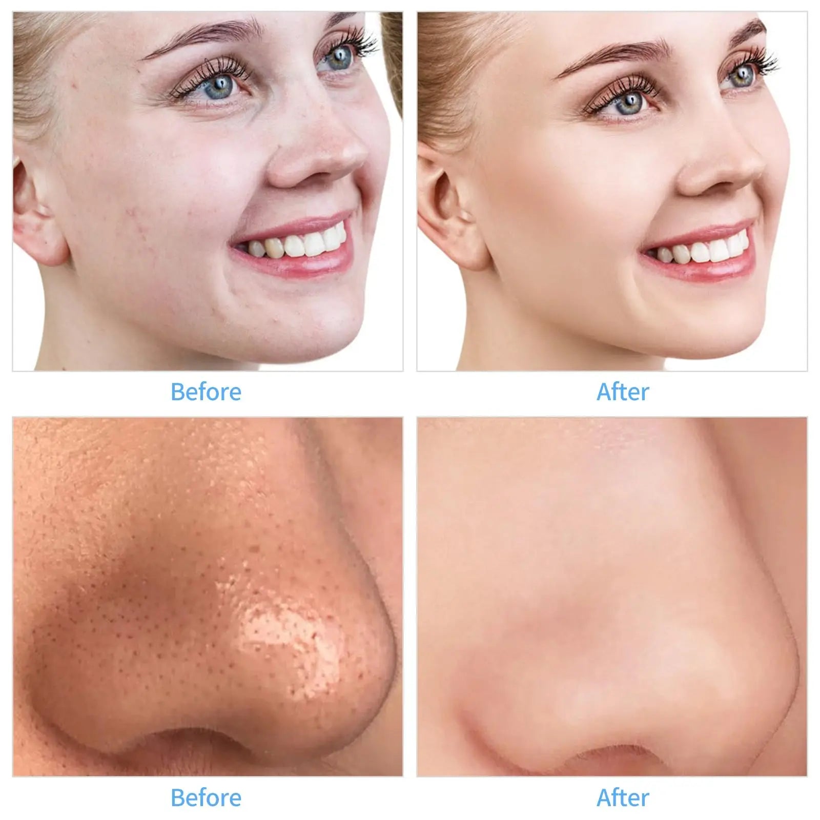 Upgraded Diamond Microdermabrasion Machine Blackhead Removal Professional Facial Deep Cleasing Device Home Use Facial Skin Care