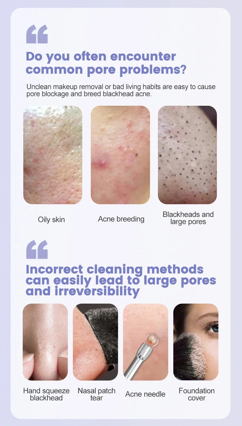 Ultrasonic Facial Skin Scrubber Deep Facial Cleaning Machine Removal Dirt Blackhead face ultrasonic skin scrubber machine