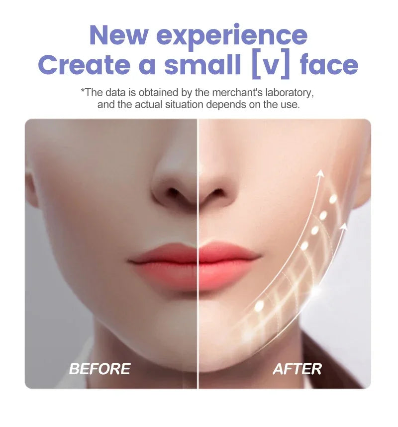 Ultrasonic Facial Skin Scrubber Deep Facial Cleaning Machine Removal Dirt Blackhead face ultrasonic skin scrubber machine