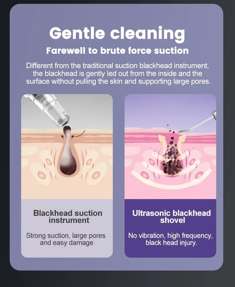 Ultrasonic Facial Skin Scrubber Deep Facial Cleaning Machine Removal Dirt Blackhead face ultrasonic skin scrubber machine