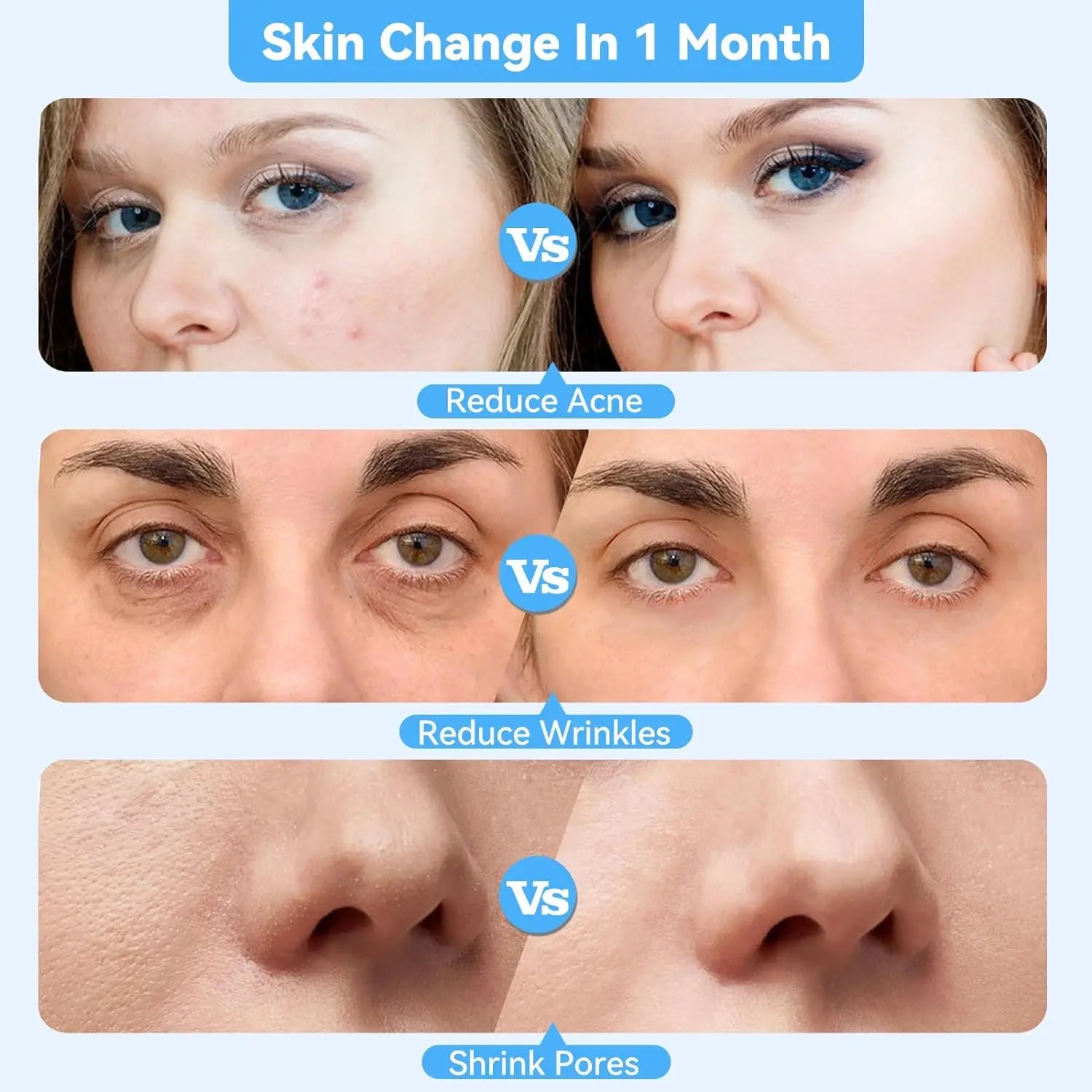 Upgraded Diamond Microdermabrasion Machine Blackhead Removal Professional Facial Deep Cleasing Device Home Use Facial Skin Care