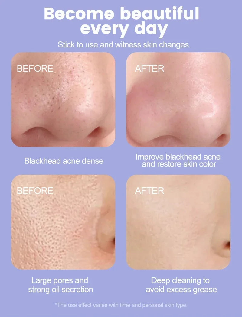 Ultrasonic Facial Skin Scrubber Deep Facial Cleaning Machine Removal Dirt Blackhead face ultrasonic skin scrubber machine