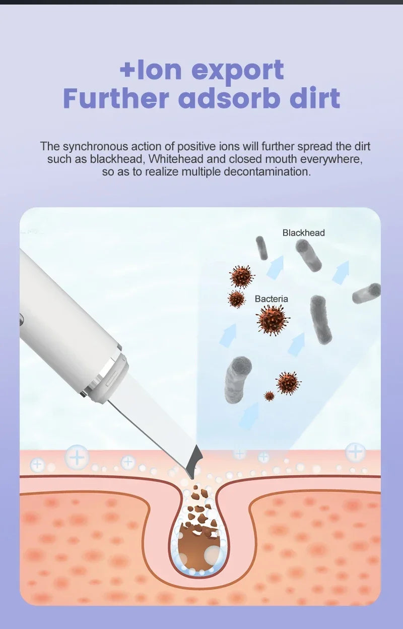Ultrasonic Facial Skin Scrubber Deep Facial Cleaning Machine Removal Dirt Blackhead face ultrasonic skin scrubber machine