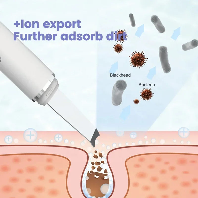 Ultrasonic Facial Skin Scrubber Deep Facial Cleaning Machine Removal Dirt Blackhead face ultrasonic skin scrubber machine